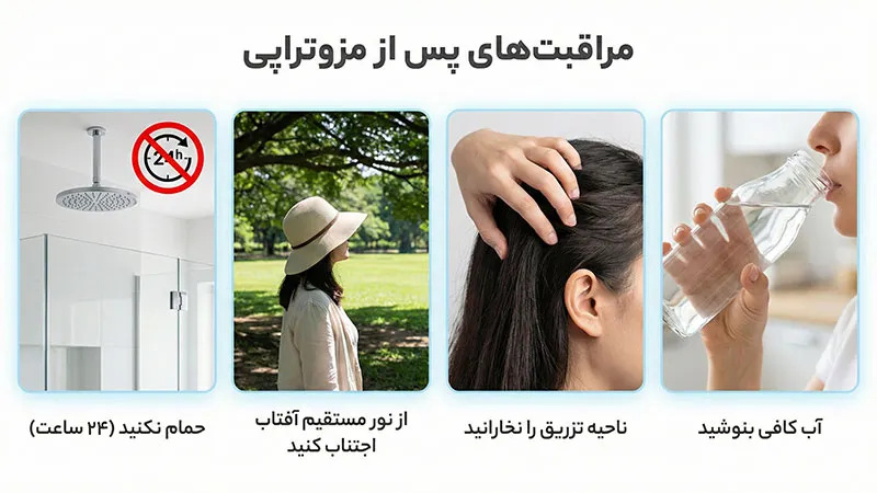 مراقبت های بعد از مزوتراپی مو