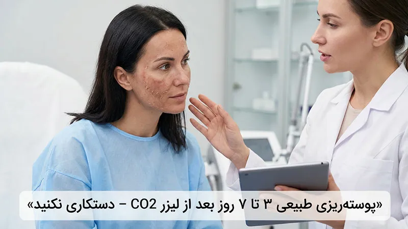 پوسته ریزی بعد از لیزر فرکشنال CO2