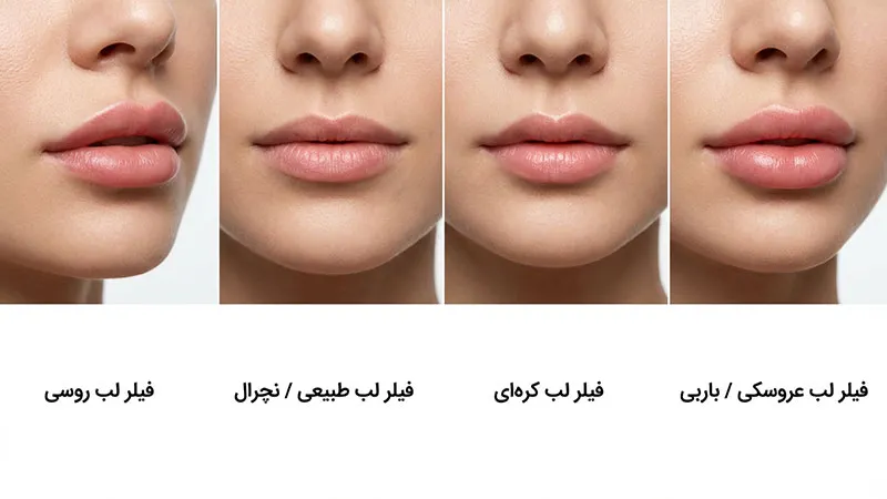 انواع مدلهای فیلر لب